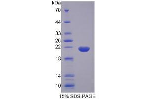 SDS-PAGE (SDS) image for Complexin 1 (CPLX1) (AA 1-134) protein (His tag) (ABIN6239370) (Complexin 1 Protein (CPLX1) (AA 1-134) (His tag))