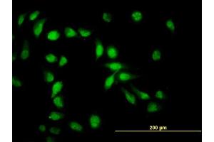 Immunofluorescence of monoclonal antibody to API5 on HeLa cell. (Apoptosis Inhibitor 5 antibody  (AA 400-504))