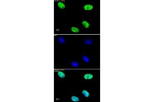 Histone H4ac (pan-acetyl) antibody (pAb) tested by immunofluorescence. (Histone H4 antibody  (acetylated))
