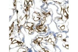 IHC analysis of CD31/PECAM1 using anti-CD31/PECAM1 antibody (ABIN7601076).