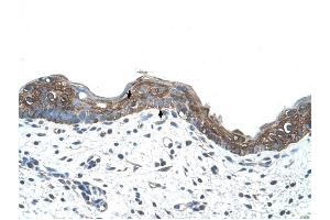 Ankyrin 1 antibody was used for immunohistochemistry at a concentration of 4-8 ug/ml to stain Squamous epithelial cells (arrows) in Human Skin. (Erythrocyte Ankyrin antibody  (C-Term))