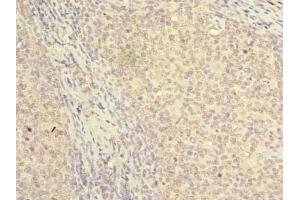 Immunohistochemistry of paraffin-embedded human tonsil tissue using ABIN7161534 at dilution of 1:100 (NKIRAS2 antibody  (AA 1-191))