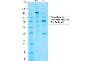 SDS-PAGE Analysis of Purified CA19-9 Rabbit Monoclonal Antibody (CA19. (CA 19-9 antibody)