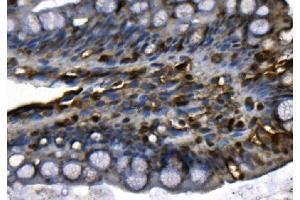 IHC analysis of MCM4 using anti-MCM4 antibody (ABIN7601485).