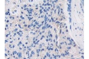 Immunohistochemistry (IHC) image for anti-Pregnancy Zone Protein (PZP) (AA 1212-1391) antibody (ABIN7436252)