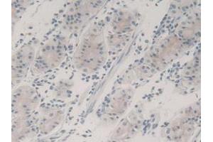 Detection of TGFb3 in Human Stomach Tissue using Monoclonal Antibody to Transforming Growth Factor Beta 3 (TGFb3) (TGFB3 antibody  (AA 24-300))