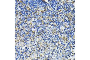 Immunohistochemistry of paraffin-embedded human appendix using CAMP antibody (ABIN7266146) at dilution of 1:200 (40x lens). (Cathelicidin antibody  (AA 31-170))