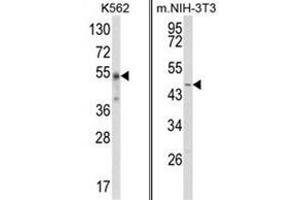 (LEFT) Western blot analysis of WDSUB1 Antibody (Center) in K562 cell line lysates (35ug/lane).