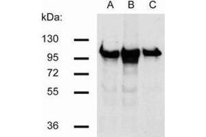 Western Blotting (WB) image for anti-Catenin (Cadherin-Associated Protein), beta 1, 88kDa (CTNNB1) antibody (ABIN614788) (CTNNB1 antibody)