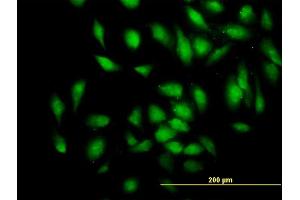 Immunofluorescence of monoclonal antibody to PDE4DIP on HeLa cell. (PDE4DIP antibody  (AA 1-177))