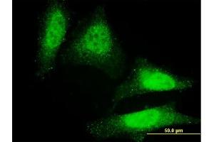Immunofluorescence of monoclonal antibody to DAZ1 on HeLa cell. (DAZ1 antibody  (AA 21-120))