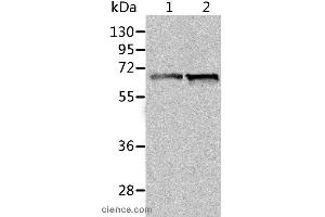 Western blot analysis of Human fetal liver and liver cancer tissue, using ALDH4A1 Polyclonal Antibody at dilution of 1:450 (ALDH4A1 antibody)