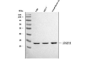 Western blot analysis of U1A/SNRPA using anti-U1A/SNRPA antibody (ABIN7600891). (SNRPA1 antibody  (AA 25-218))