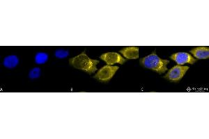 Immunocytochemistry/Immunofluorescence analysis using Rabbit Anti-SOD (Mn) Polyclonal Antibody . (SOD2 antibody  (PE))