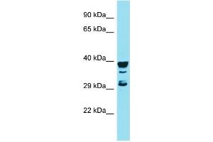 Host: Rabbit Target Name: RGS7BP Sample Type: MCF7 Whole Cell lysates Antibody Dilution: 1. (RGS7BP antibody  (Middle Region))