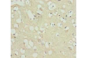 Immunohistochemistry of paraffin-embedded human brain tissue using ABIN7158523 at dilution of 1:100 (ACSL6 antibody  (AA 458-697))