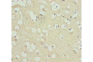 Immunohistochemistry of paraffin-embedded human brain tissue using ABIN7158523 at dilution of 1:100