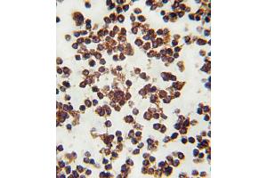 Formalin-fixed and paraffin-embedded human lymph tissue reacted with ALOX15 antibody (C-term), which was peroxidase-conjugated to the secondary antibody, followed by DAB staining. (ALOX15 antibody  (C-Term))
