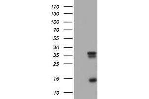 Image no. 6 for anti-Thymidylate Synthetase (TYMS) antibody (ABIN1501595) (TYMS antibody)