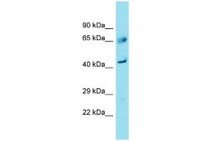 Western Blotting (WB) image for anti-Family with Sequence Similarity 83, Member A (FAM83A) (C-Term) antibody (ABIN2791509) (FAM83A antibody  (C-Term))