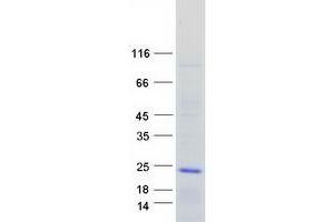 Western Blotting (WB) image for Adenylate Cyclase Activating Polypeptide 1 (Pituitary) (ADCYAP1) (Transcript Variant 2) protein (Myc-DYKDDDDK Tag) (ABIN2714397)