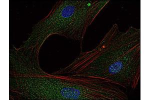Immunocytochemistry (ICC) image for anti-FYN Oncogene Related To SRC, FGR, YES (FYN) (AA 7-176) antibody (ABIN94311)