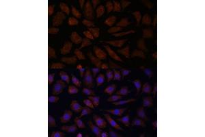 Immunofluorescence analysis of L929 cells using O antibody (ABIN7265319) at dilution of 1:100. (OAS3 antibody  (AA 320-620))