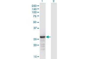 Western Blot analysis of ANP32B expression in transfected 293T cell line by ANP32B monoclonal antibody (M05), clone 8E10. (ANP32B antibody  (AA 1-251))
