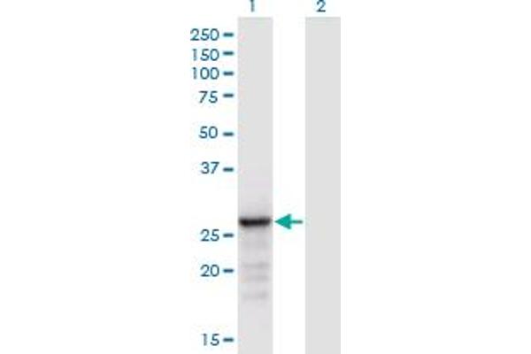 ANP32B Antikörper  (AA 1-251)