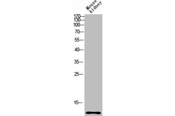 CCL27 antibody  (Internal Region)