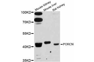 Western blot analysis of extracts of various cell lines, using PORCN antibody (ABIN6292717) at 1:3000 dilution. (PORCN antibody)