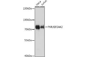 Western blot analysis of extracts of various cell lines, using PKR/PKR/EIF2 antibody (ABIN1679688 and ABIN3018462) at 1:1000 dilution. (EIF2AK2 antibody)
