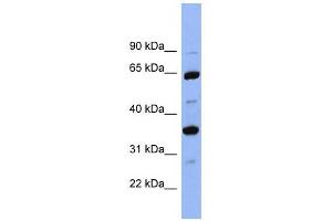 SERPINC1 antibody used at 1 ug/ml to detect target protein.