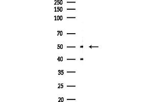 anti-Mitochondrial Ribosomal Protein S27 (MRPS27) (N-Term) antibody