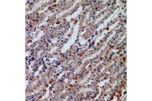 Immunohistochemical analysis of Caldesmon staining in human kidney formalin fixed paraffin embedded tissue section. (Caldesmon antibody  (N-Term))