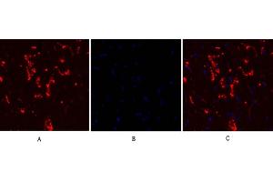 Immunofluorescence analysis of rat heart tissue. (Connexin 43/GJA1 antibody  (AA 310-390))