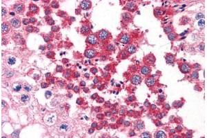 Human Testis: Formalin-Fixed, Paraffin-Embedded (FFPE) (SH3GLB1 antibody  (AA 1-366))