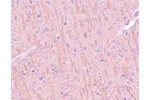 Immunohistochemistry of rat brain tissue with CCDC106 polyclonal antibody  at 5 ug/mL. (CCDC106 antibody  (C-Term))
