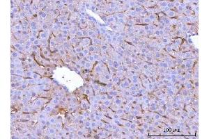 IHC analysis of MRC1 using anti-MRC1 antibody (ABIN7600593).