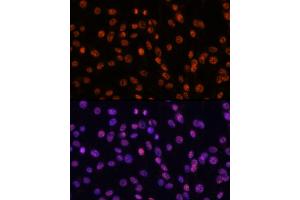Immunofluorescence (IF) image for anti-Splicing Factor 3b, Subunit 1, 155kDa (SF3B1) (AA 1-144) antibody (ABIN7270543)