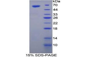 SDS-PAGE analysis of Mouse TGM1 Protein. (TGM1 Protein)
