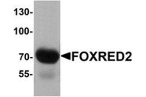 Western blot analysis of FOXRED2 in human lung tissue lysate with FOXRED2 antibody at 1 μg/mL. (FOXRED2 antibody  (N-Term))