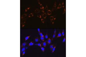 Immunohistochemistry of paraffin-embedded human esophageal cancer using ATPB Rabbit mAb (ABIN7265722) at dilution of 1:100 (40x lens). (ATP5B antibody)