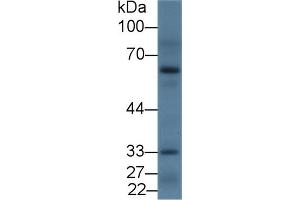 Detection of DRD2 in Rat Cerebrum lysate using Polyclonal Antibody to Dopamine Receptor D2 (DRD2) (Dopamine d2 Receptor antibody  (AA 194-421))