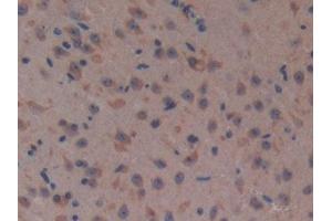 Detection of CFH in Mouse Brain Tissue using Polyclonal Antibody to Complement Factor H (CFH) (Complement Factor H antibody  (AA 915-1156))