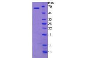 Image no. 1 for UDP-Gal:betaGlcNAc beta 1,3-Galactosyltransferase, Polypeptide 5 (B3GALT5) (AA 29-310) protein (His tag,GST tag) (ABIN4990914) (B3GALT5 Protein (AA 29-310) (His tag,GST tag))