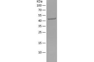 Western Blotting (WB) image for Fibronectin (AA 1008-1231) protein (His-IF2DI Tag) (ABIN7122958)