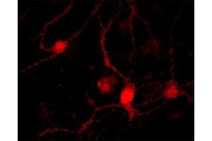 Immunocytochemistry (ICC) image for anti-RAB26, Member RAS Oncogene Family (RAB26) antibody (ABIN1742529) (RAB26 antibody)