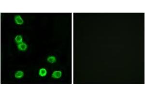 Immunofluorescence analysis of MCF7 cells, using GPR63 Antibody. (GPR63 antibody  (AA 370-419))