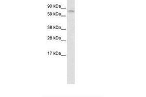 Image no. 1 for anti-Far Upstream Element (FUSE) Binding Protein 1 (FUBP1) (AA 40-89) antibody (ABIN202847) (FUBP1 antibody  (AA 40-89))